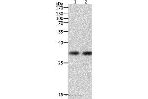 Western blot analysis of k562 cell and Hela cell, using HAVCR1 Polyclonal Antibody at dilution of 1:700 (HAVCR1 antibody)