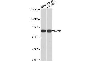 Western blot analysis of extracts of various cell lines, using SOX9 antibody. (SOX9 antibody  (AA 100-200))