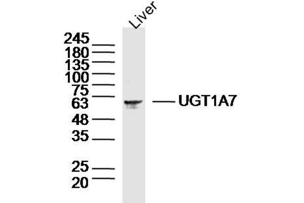 UGT1A7 抗体  (AA 431-531)