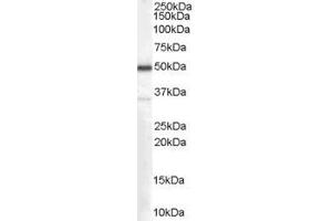 Western Blotting (WB) image for anti-Chromogranin A (CHGA) (Internal Region) antibody (ABIN2465199) (Chromogranin A antibody  (Internal Region))