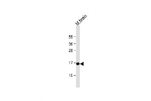 Western Blot at 1:1000 dilution + mouse brain lysate Lysates/proteins at 20 ug per lane. (Complexin 1 antibody  (AA 33-60))