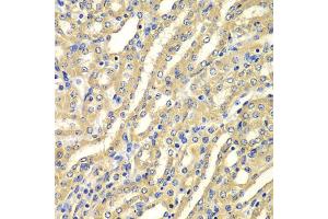Immunohistochemistry of paraffin-embedded mouse kidney using WIPI2 antibody (ABIN5975599) at dilution of 1/100 (40x lens). (WIPI2 antibody)