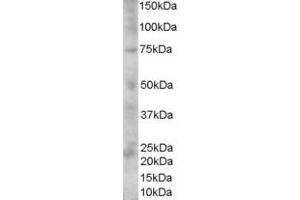 ABIN185660 (1µg/ml) staining of Human Skin lysate (35µg protein in RIPA buffer). (Melanoma gp100 antibody  (C-Term))