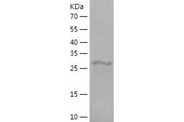 RPL8 Protein (AA 1-257) (His tag)