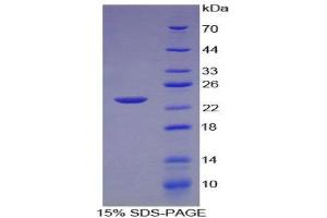SDS-PAGE (SDS) image for Lymphotoxin-alpha (LTA) (AA 36-205) protein (His tag) (ABIN2127132)