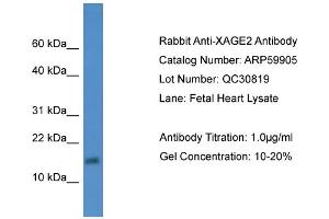 WB Suggested Anti-XAGE2  Antibody Titration: 0.