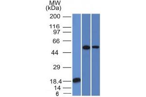 Western Blot Analysis (A) Recombinant protein (B) A549 (C) A431 TOX3 Mouse Monoclonal Antibody (TOX3/1124). (TOX3 antibody  (AA 251-389))