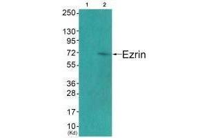 Western blot analysis of extracts from COS7 cells (Lane 2), using Ezrin (Ab-478) antiobdy. (Ezrin antibody  (Tyr478))