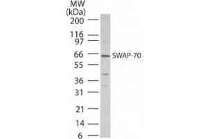 Image no. 1 for anti-SWAP Switching B-Cell Complex 70kDa Subunit (SWAP70) (AA 300-350) antibody (ABIN199974) (SWAP70 antibody  (AA 300-350))