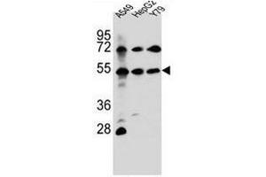 FGFRL1 Antibody (N-term) western blot analysis in A549,HepG2,Y79 cell line lysates (35µg/lane). (FGFRL1 antibody  (N-Term))