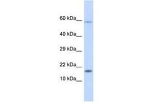 Image no. 1 for anti-Hect Domain and RLD 4 (HERC4) (AA 39-76) antibody (ABIN6746210) (HERC4 antibody  (AA 39-76))