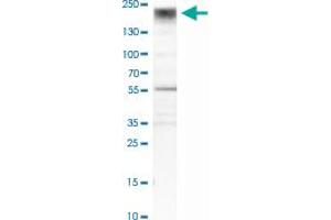 Western Blot analysis of HeLa cell lysate with COL3A1 polyclonal antibody . (COL3A1 antibody)