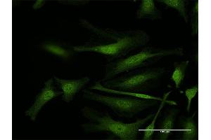 Immunofluorescence of purified MaxPab antibody to IFI35 on HeLa cell. (IFI35 antibody  (AA 1-288))