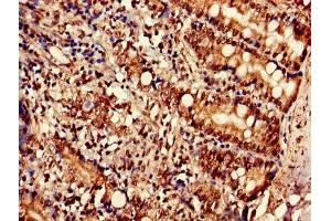 Immunohistochemistry of paraffin-embedded human small intestine tissue using ABIN7170231 at dilution of 1:100 (SLC35F2 antibody  (AA 335-374))