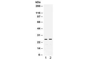 Western blot testing of 1) rat liver and 2) mouse liver lysate with GSTA antibody. (GSTA (Alpha 1-5) antibody)