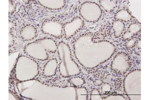 Immunoperoxidase of purified MaxPab antibody to ILF2 on formalin-fixed paraffin-embedded human thyroid nodular goiter. (ILF2 antibody  (AA 1-390))