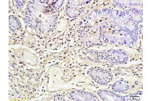 Formalin-fixed and paraffin embedded rat colon labeled with Anti-CD177/NB1 Polyclonal Antibody, Unconjugated (ABIN687187) followed by conjugation to the secondary antibody and DAB staining (CD177 antibody  (AA 521-650))