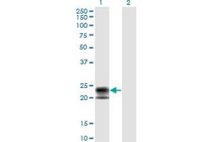Western Blot analysis of TNFRSF17 expression in transfected 293T cell line by TNFRSF17 monoclonal antibody (M01), clone 1F10. (BCMA antibody  (AA 1-184))