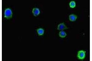Immunofluorescent analysis of HepG2 cells using ABIN7158488 at dilution of 1:100 and Alexa Fluor 488-congugated AffiniPure Goat Anti-Rabbit IgG(H+L) (LONP1 antibody  (AA 614-959))