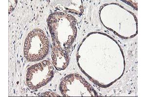 Image no. 4 for anti-Chromosome X Open Reading Frame 26 (CXorf26) antibody (ABIN1497690) (CXorf26 antibody)