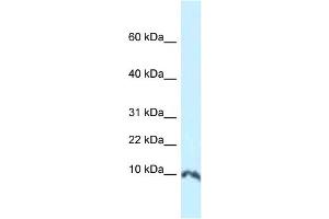 WB Suggested Anti-Sumo1 Antibody   Titration: 1. (SUMO1 antibody  (N-Term))
