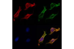 ABIN6262775 and ABIN6269025 staining HepG2 by IF/ICC.