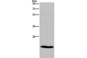 Western Blot analysis of Mouse heart tissue using CMTM5 Polyclonal Antibody at dilution of 1:400