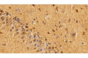 Detection of S100B in Bovine Cerebellum Tissue using Polyclonal Antibody to S100 Calcium Binding Protein B (S100B)