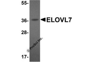 Western Blotting (WB) image for anti-ELOVL Fatty Acid Elongase 7 (ELOVL7) (N-Term) antibody (ABIN1031366)