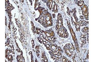 IHC analysis of Tryptophan Hydroxylase/TPH1 using anti-Tryptophan Hydroxylase/TPH1 antibody (ABIN7601556). (Tryptophan Hydroxylase 1 antibody  (AA 383-444))