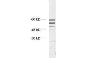 dilution: 1 : 2000, sample: crude synaptosomal fraction of rat brain (P2) (STXBP2 antibody)