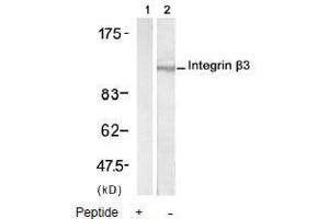 Image no. 2 for anti-Integrin beta 3 (ITGB3) (AA 771-775) antibody (ABIN197246)