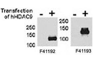 HDAC9 antibody NSJ# F41192 and NSJ# F41193 were tested by WB and IP-WB using HeLa and HeLa-HDAC9 transfected cells. (HDAC9 antibody  (AA 2-32))
