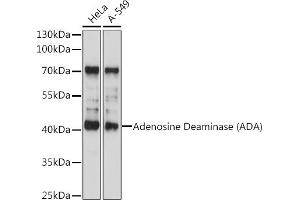 Western blot analysis of extracts of various cell lines, using Adenosine Deaminase (Adenosine Deaminase (ADA)) antibody (ABIN6127410, ABIN6136515, ABIN6136516 and ABIN6218080) at 1:1000 dilution. (ADA antibody  (AA 1-363))