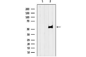 anti-Solute Carrier Family 22 Member 5 (SLC22A5) (C-Term) antibody