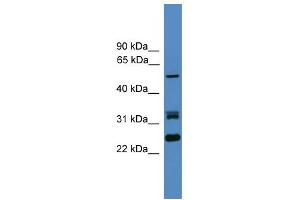 WB Suggested Anti-LRRFIP2 Antibody Titration: 0. (LRRFIP2 antibody  (N-Term))