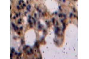 IHC-P analysis of Lung tissue, with DAB staining. (LIFR antibody  (AA 522-691))