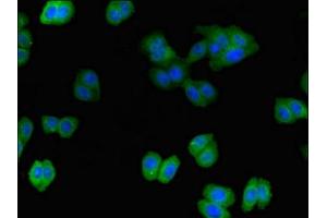 Immunofluorescent analysis of HepG2 cells using ABIN7156953 at dilution of 1:100 and Alexa Fluor 488-congugated AffiniPure Goat Anti-Rabbit IgG(H+L) (Intersectin 2 antibody  (AA 940-1209))