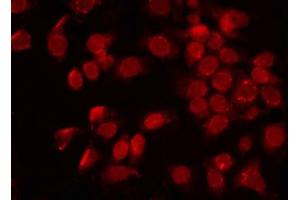 ABIN6272288 staining 293 by IF/ICC. (POLL antibody  (C-Term))