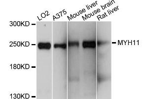 Western blot analysis of extracts of various cell lines, using MYH11 antibody (ABIN4904464) at 1:1000 dilution. (MYH11 antibody)