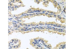 Immunohistochemistry of paraffin-embedded Human prostate using OSM Polyclonal Antibody at dilution of 1:100 (40x lens). (Oncostatin M antibody)