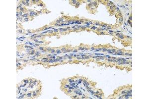 Immunohistochemistry of paraffin-embedded Human prostate using OSM Polyclonal Antibody at dilution of 1:100 (40x lens).