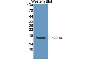 Detection of Recombinant CDA, Human using Polyclonal Antibody to Cytidine Deaminase (CDA)