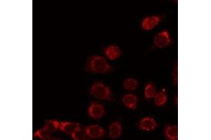 ABIN6276274 staining HepG2 by IF/ICC. (F2RL3 antibody  (N-Term))