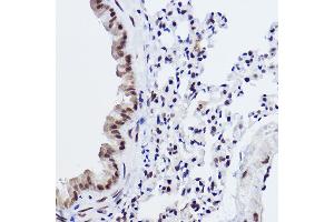 Immunohistochemistry (IHC) image for anti-Mediator Complex Subunit 4 (MED4) antibody (ABIN7268445)
