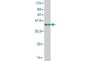Western Blot detection against Immunogen (41. (ASK1 antibody  (AA 1231-1374))