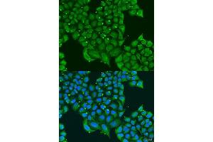 Immunofluorescence analysis of U2OS cells using ATPIF1 antibody. (ATPase Inhibitory Factor 1 antibody  (AA 26-106))