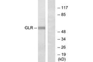 Western blot analysis of extracts from COLO205 cells, using GLR Antibody. (GLRa2 antibody  (AA 95-144))