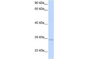 XRCC2 antibody used at 1 ug/ml to detect target protein. (XRCC2 antibody  (Middle Region))