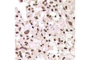 Immunohistochemistry (Paraffin-embedded Sections) (IHC (p)) image for anti-X-Ray Repair Complementing Defective Repair in Chinese Hamster Cells 6 (XRCC6) (AA 500-600) antibody (ABIN1513143)